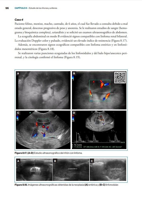Producto - Núñez: Atlas Rápido de Ecografía Abdominal + Atlas Clínico de Ecografía Doppler - 8