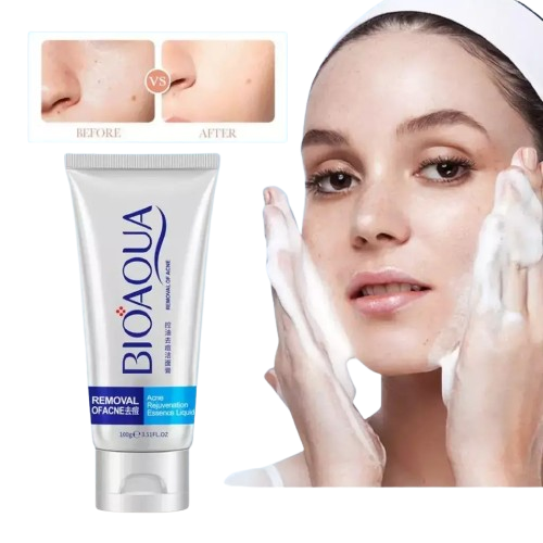 Producto - Gel limpiador, espuma p/acné LND 6/26
