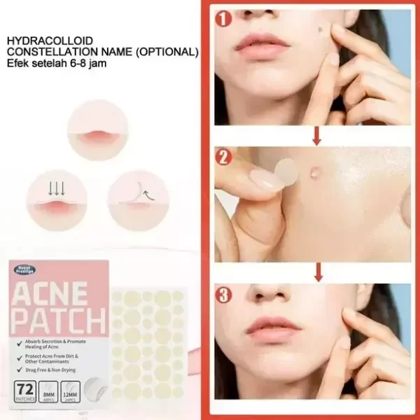 Producto - ROYAL PRESTIGE ACNE PATCH (72 PCS)