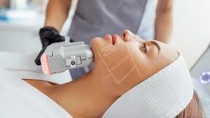 Producto - HIFU + EXOSOMAS (rostro+sub.menton)