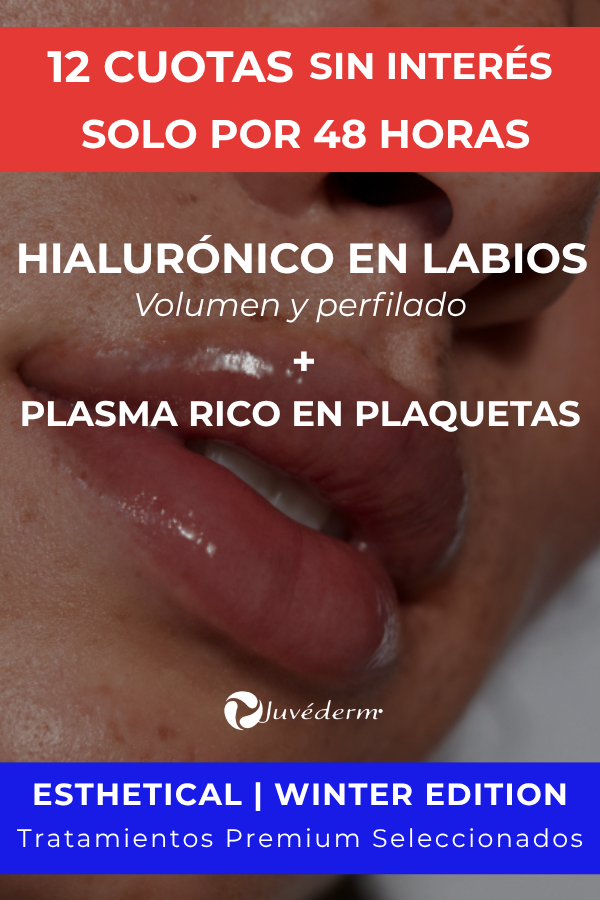 Producto - Volumen y perfilado de labios + Plasma Rico - Winter Edition